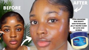 A screenshot from Kaiser Coby's youtube page, of her showing a before/after of slugging with vaseline