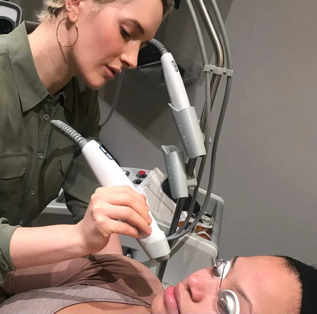 A photo of Sofie Pavitt taken from her instagram of her microneedling a client